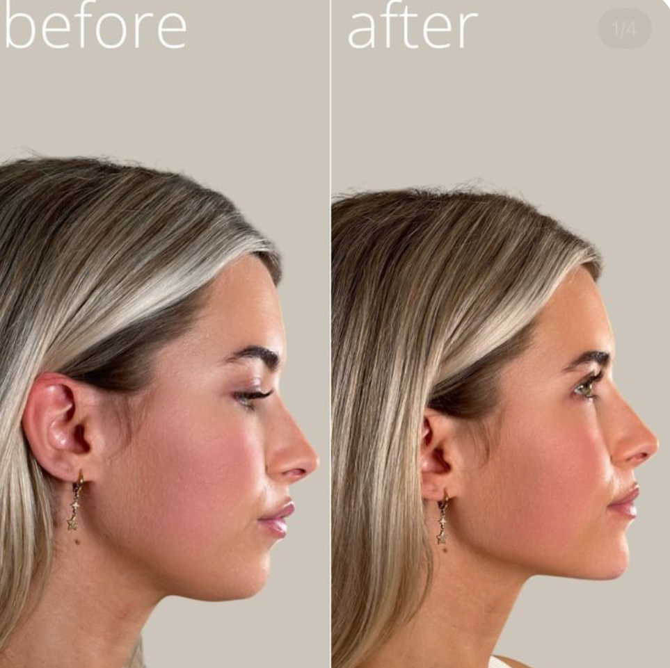 Porefect® Lymphatic Contour Face Brush