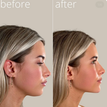 Porefect® Lymphatic Contour Face Brush